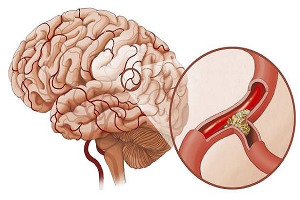 Lưu bản nháp tự động