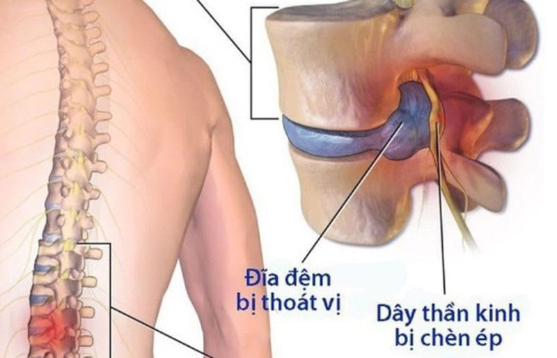 Lưu bản nháp tự động